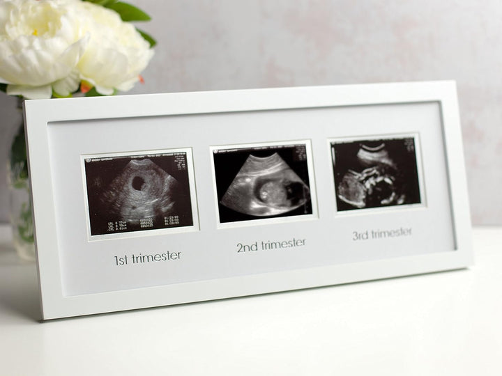 Sonogram Progression Frame - Trimester by Trimester Pregnancy Milestone Keepsake, Gender-Neutral Nursery Decor, Displays 1St, 2Nd & 3Rd Trimester Ultrasound Photos, White