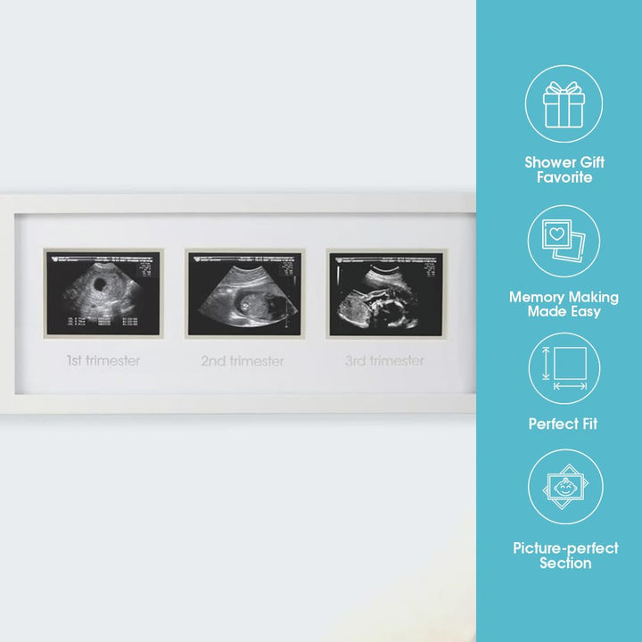 Sonogram Progression Frame - Trimester by Trimester Pregnancy Milestone Keepsake, Gender-Neutral Nursery Decor, Displays 1St, 2Nd & 3Rd Trimester Ultrasound Photos, White