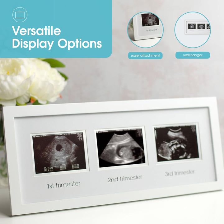 Sonogram Progression Frame - Trimester by Trimester Pregnancy Milestone Keepsake, Gender-Neutral Nursery Decor, Displays 1St, 2Nd & 3Rd Trimester Ultrasound Photos, White