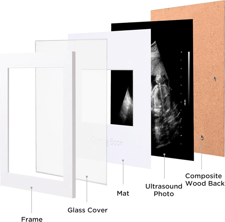 Ultrasound Picture Frame with Real Glass Cover and 3 Different Mats, 7X7 Baby Keepsake Frame for 3X4 Inches Sonogram Photo, Wall Mount or Tabletop Display, Pregnancy Announcement, White