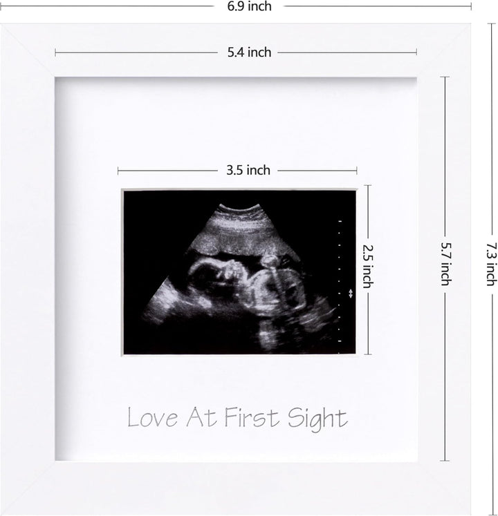Ultrasound Picture Frame with Real Glass Cover and 3 Different Mats, 7X7 Baby Keepsake Frame for 3X4 Inches Sonogram Photo, Wall Mount or Tabletop Display, Pregnancy Announcement, White