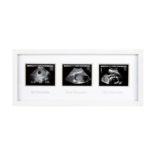 Sonogram Progression Frame - Trimester by Trimester Pregnancy Milestone Keepsake, Gender-Neutral Nursery Decor, Displays 1St, 2Nd & 3Rd Trimester Ultrasound Photos, White