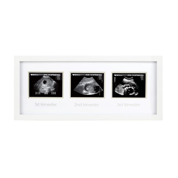 Sonogram Progression Frame - Trimester by Trimester Pregnancy Milestone Keepsake, Gender-Neutral Nursery Decor, Displays 1St, 2Nd & 3Rd Trimester Ultrasound Photos, White